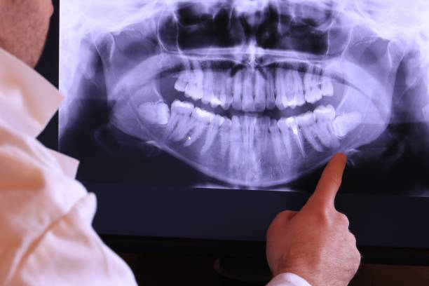 Best Urgent Care for Lost Fillings or Crowns in Loogootee, IN
